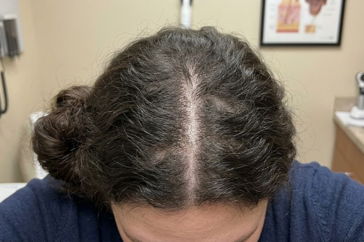 After treatment